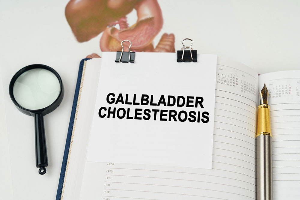 Gallbladder_Cholesterosis-lawsuit-Attorney-Missouri